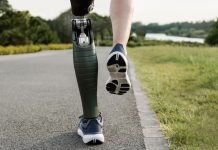 Вопрос к юристу: как получить протезирование протезы любой сложности